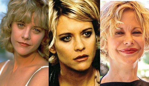 meg-ryan-plastic-surgery-before-and-after-photos.jpg
